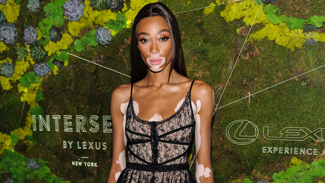 Winnie Harlow