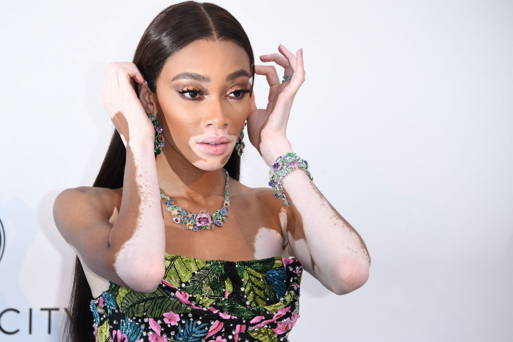 Cay Skin - Suncare that puts your skin first. By Winnie Harlow