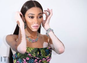 Winnie Harlow Poses At The Cannes Gala