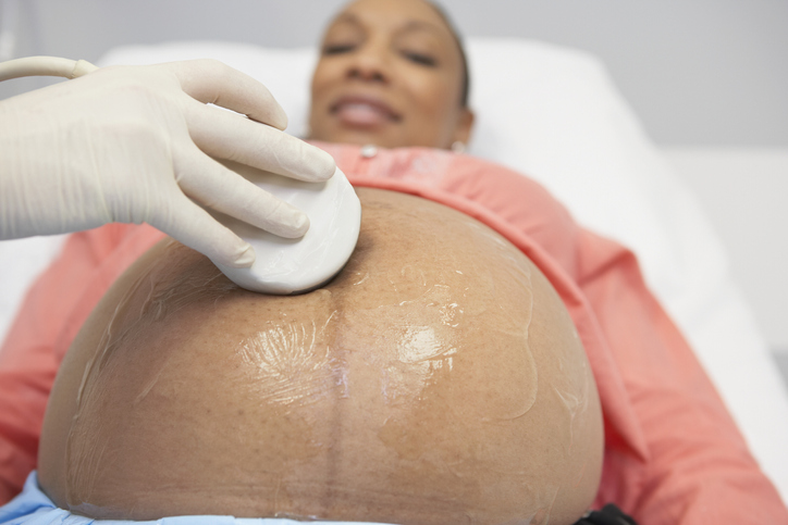 Close up of pregnant African woman having ultrasound