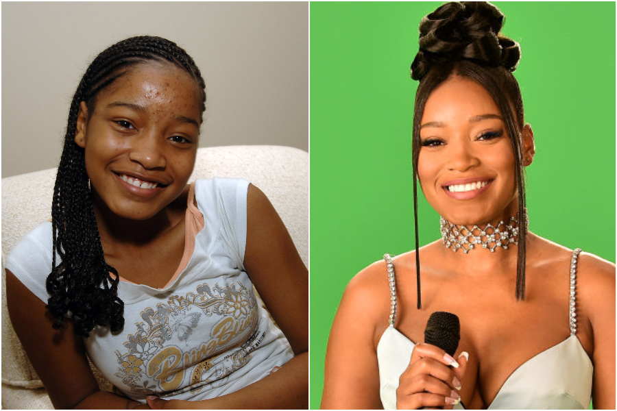 Keke Palmer skin