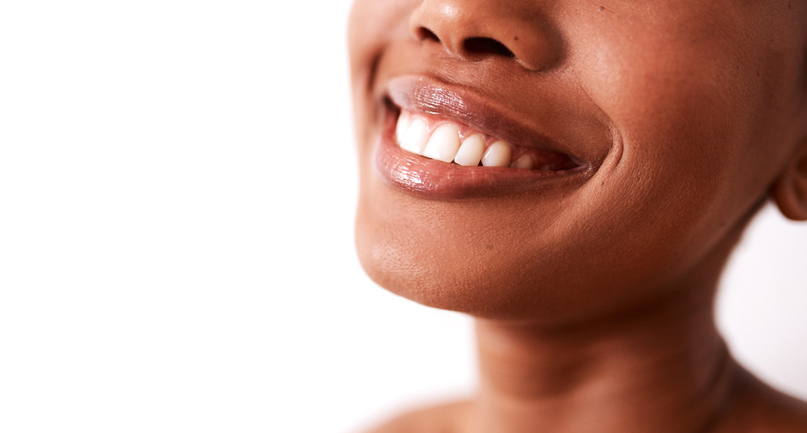 veneers, teeth, tech, certificate