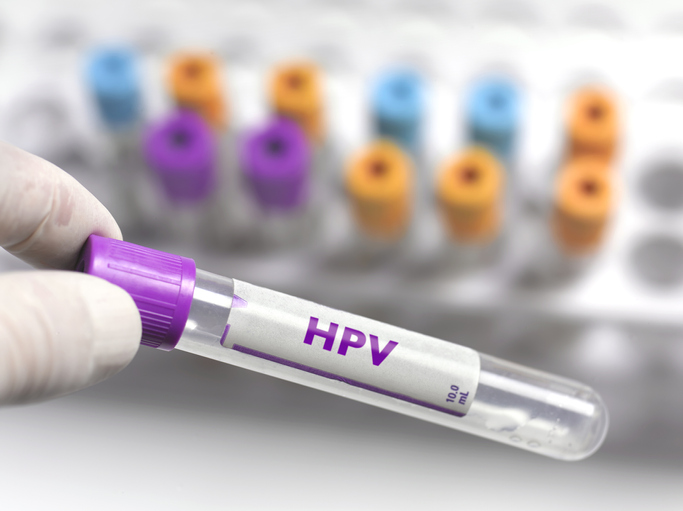 HPV positive