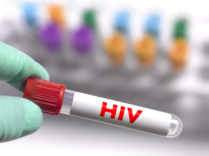 Test tube containing HIV vaccine