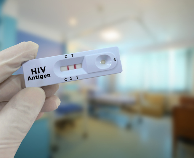 Doctor hold HIV antigen positive test result rapid test cassette.