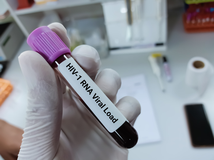 Biochemist of Scientist holds blood sample for HIV-1 RNA viral load test.