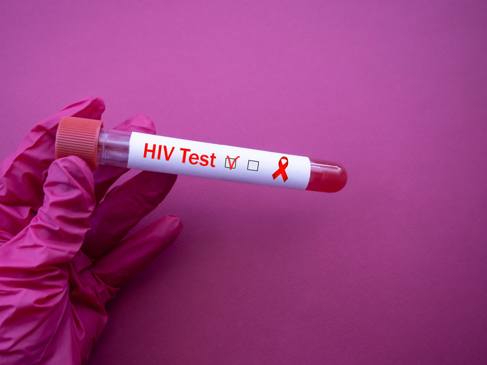 Blood collection tube with HIV test. The doctor's hand holds a positive blood sample for the infection. Red Ribbon HIV, AIDS. episode on HIV in the Black community