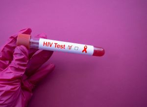 Blood collection tube with HIV test. The doctor's hand holds a positive blood sample for the infection. Red Ribbon HIV, AIDS. episode on HIV in the Black community