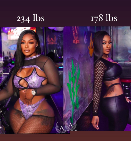 Maddy Morebucks weight loss surgery influencer Instagram mini sleeve Haitian before after
