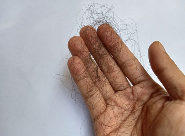 Hair loss, GLP-1 Hair loss, GLP-1 Medication
