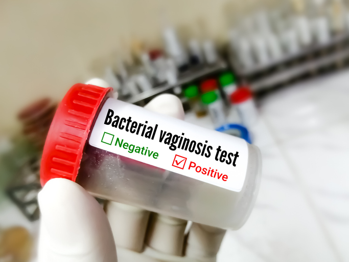 Bacterial vaginosis test, a common vaginal infection caused by an overgrowth of certain bacteria. UTI