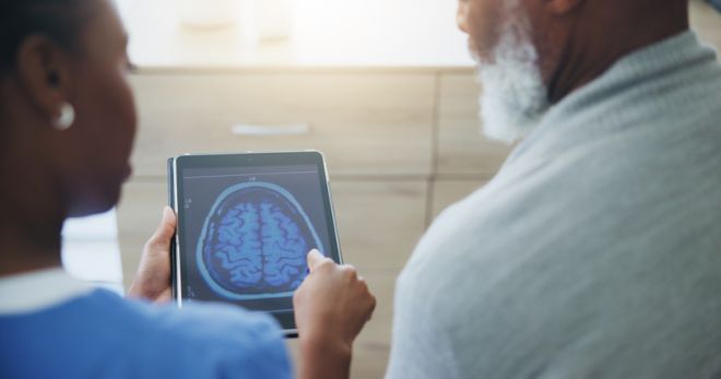Alzheimer, dementia or memory loss, Dr Zaldy S. Tan, function, brain