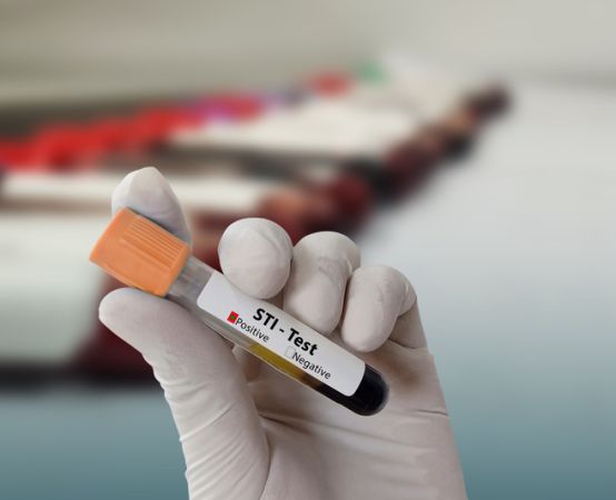 Dr. Stacey De-Lin, burning, itching, vagina, STIS, vaginal 