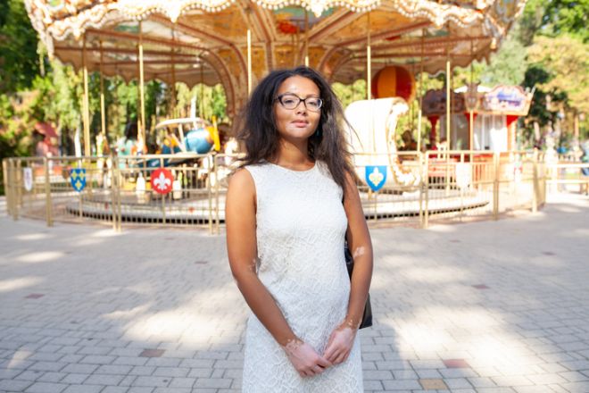 Confident woman with vitiligo standing at sunny amusement park