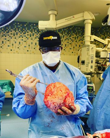 A surgeon wearing a "Xavier Made" cap and surgical mask, holding a large, bloody organ in an operating room.