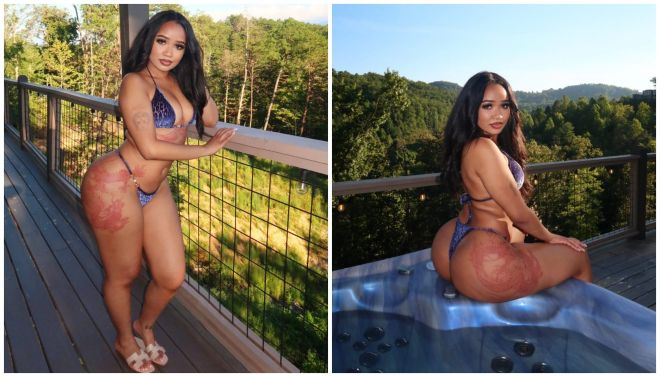 A woman in a blue bikini sitting on a deck overlooking a wooded landscape.
